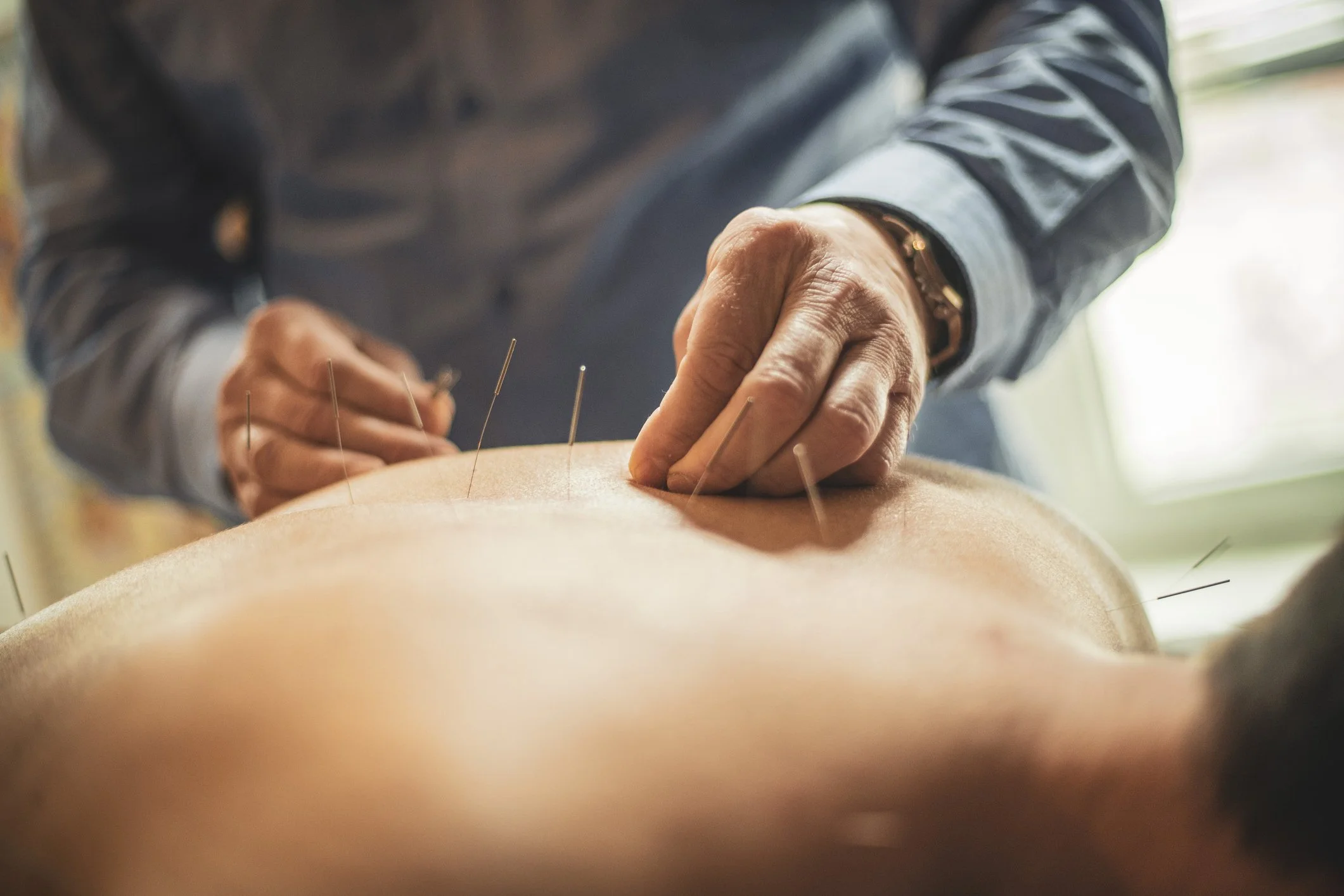 Hendersonville Acupuncture: How Needle Stimulation May Influence Cellular Behavior