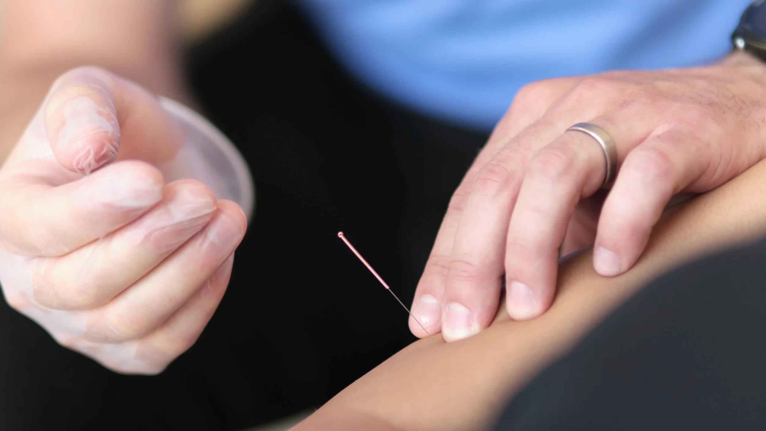 Davin Physiotherapist IMS/Dry needling at Aeris Physiotherapy