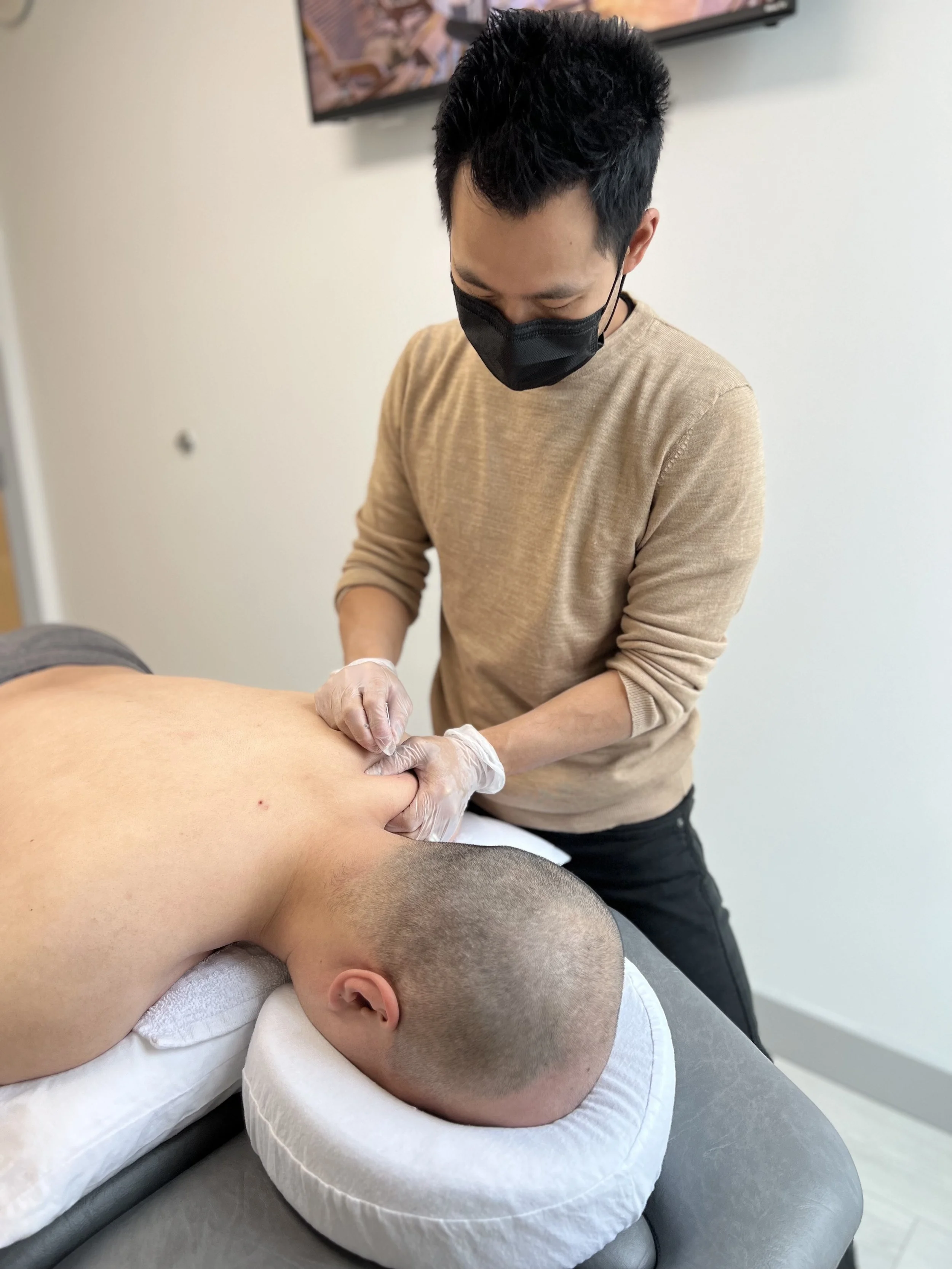 IMS needling port moody