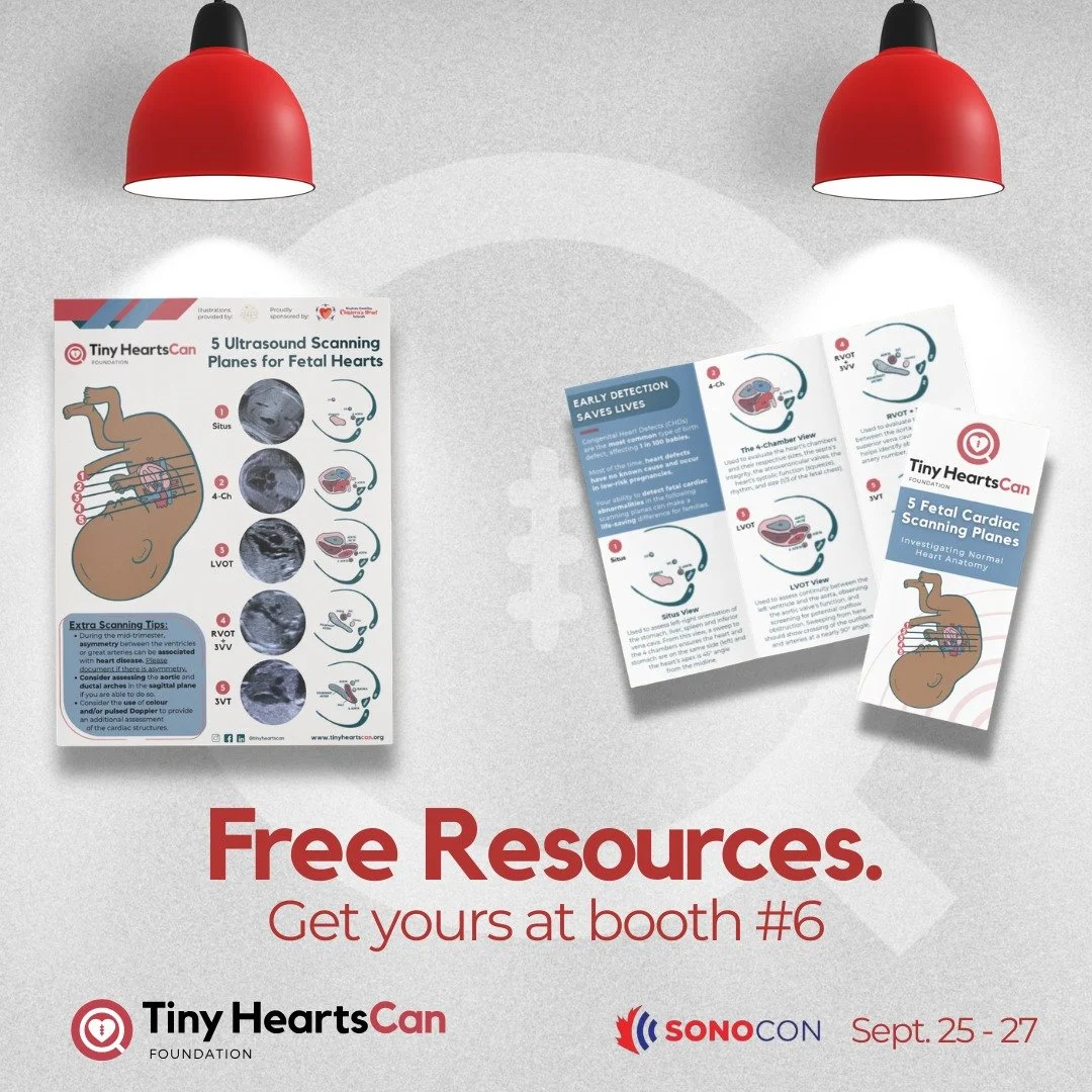 We've got 170 Scanning Planes Posters packed up and ready to find some new homes! 

Find us this weekend at SonoCon in Calgary and check out all we have to offer at our booth, including these two helpful resources.

Want to sport some Tiny HeartsCan 