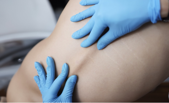 Cirugía de piel en Panamá: cuándo es necesaria y por qué acudir al dermatólogo