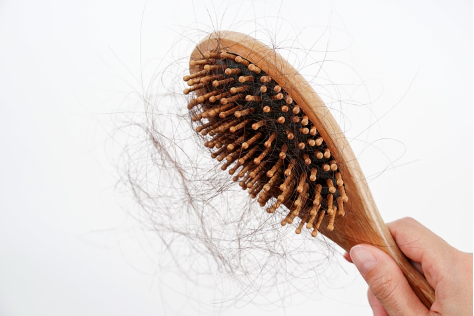 Alopecias (calvicie): causas, tipos y opciones de tratamiento