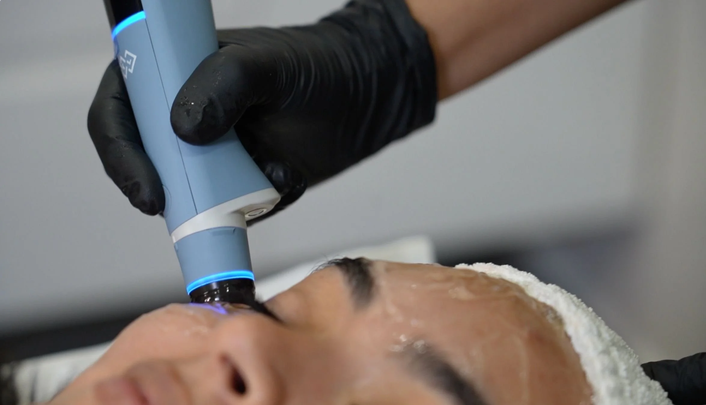 EXION en Panamá: descubre cómo funciona esta innovadora tecnología para rejuvenecer rostro y cuerpo