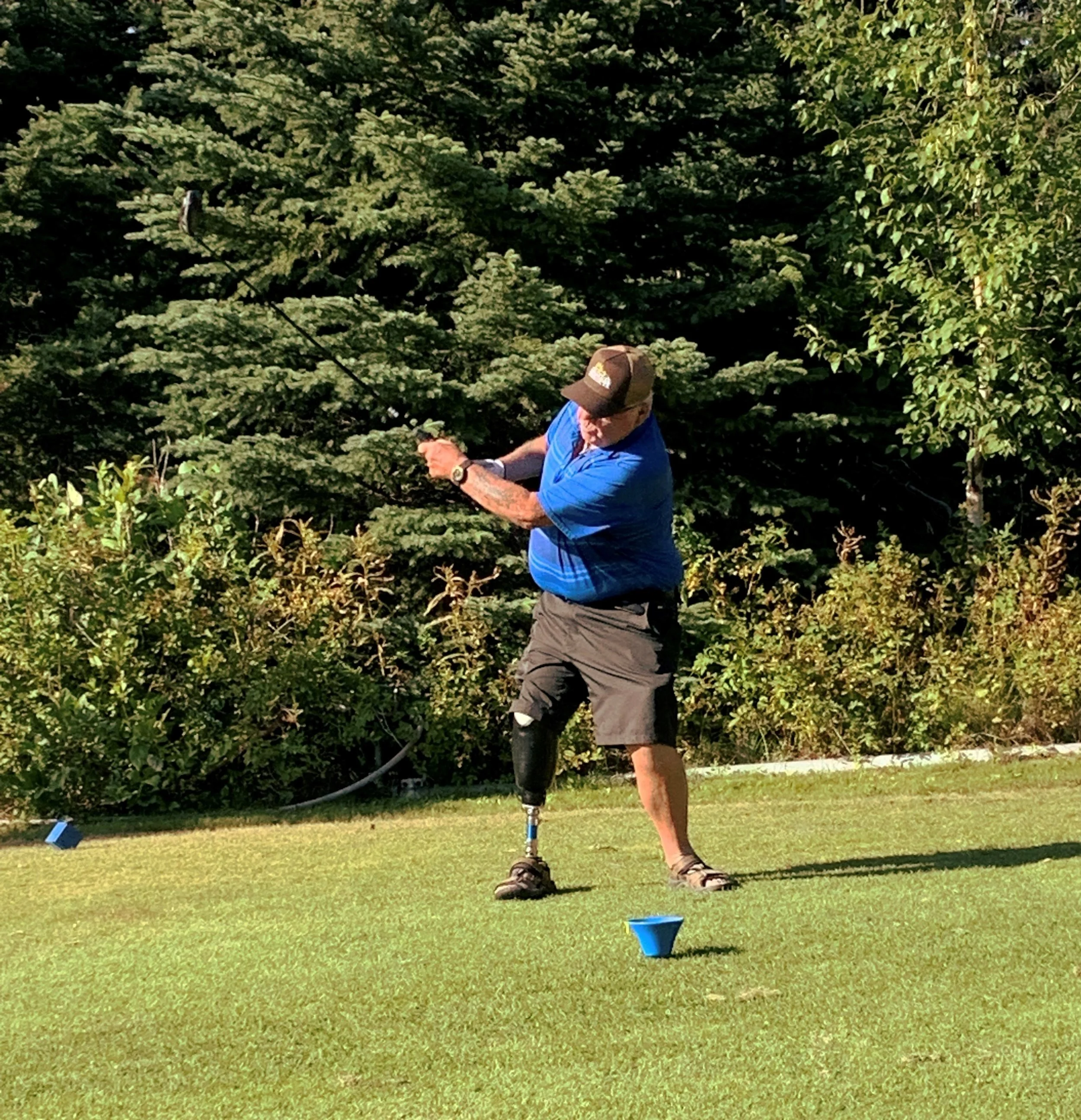 Prosthetics — BC Brace & Limb