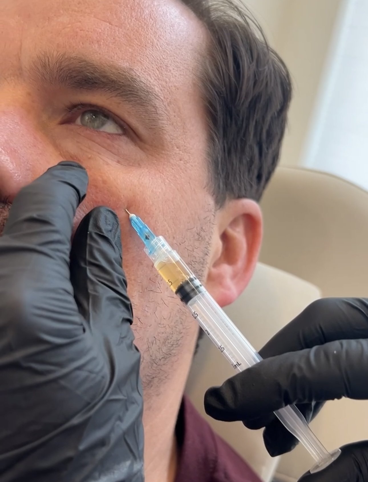 Injectable Services — Jolie Aesthetics & Wellness