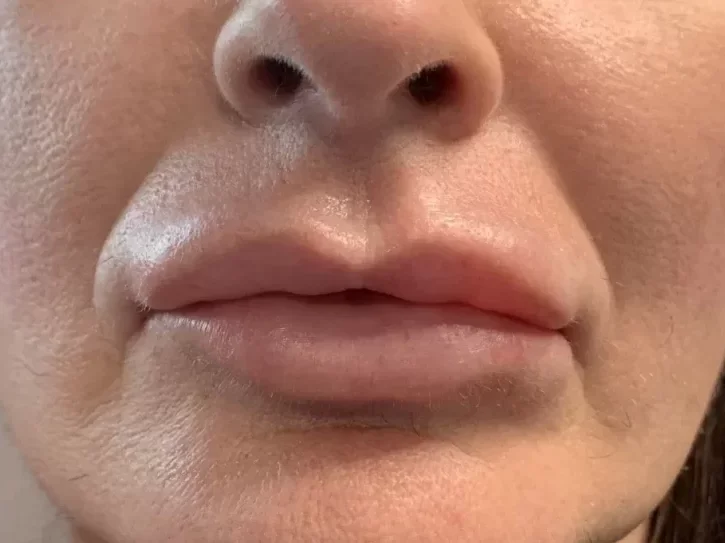 Close-up of a person's lips and nose.