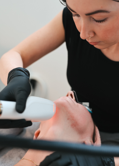 A woman performing a laser treatment on a person's face in a clinical setting.