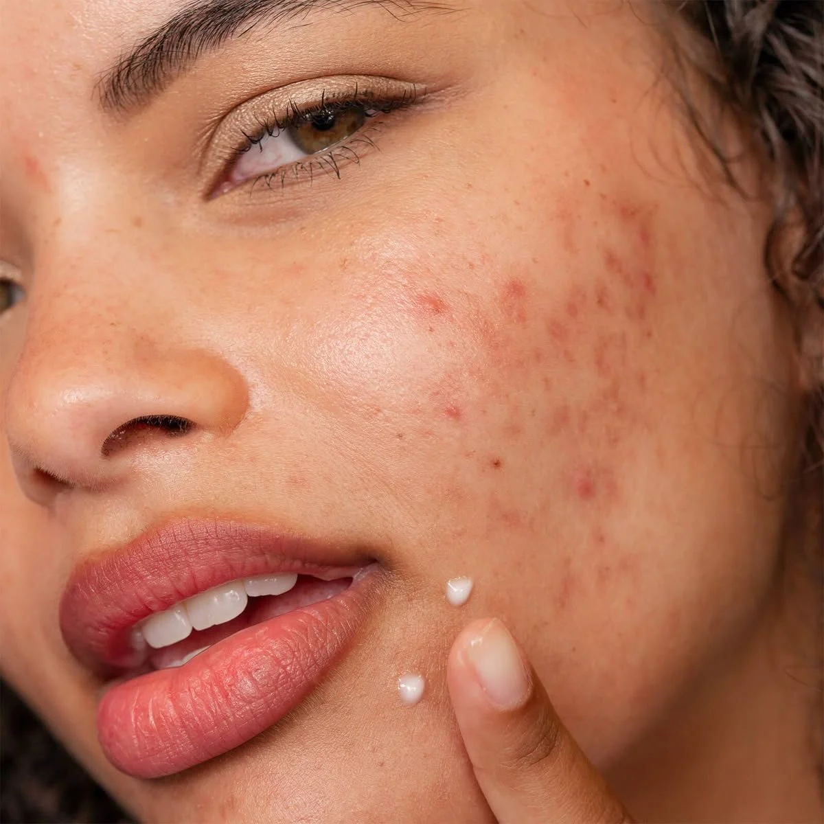 A close-up of a woman with brown eyes and fair skin, applying skincare cream to her cheek with her finger.