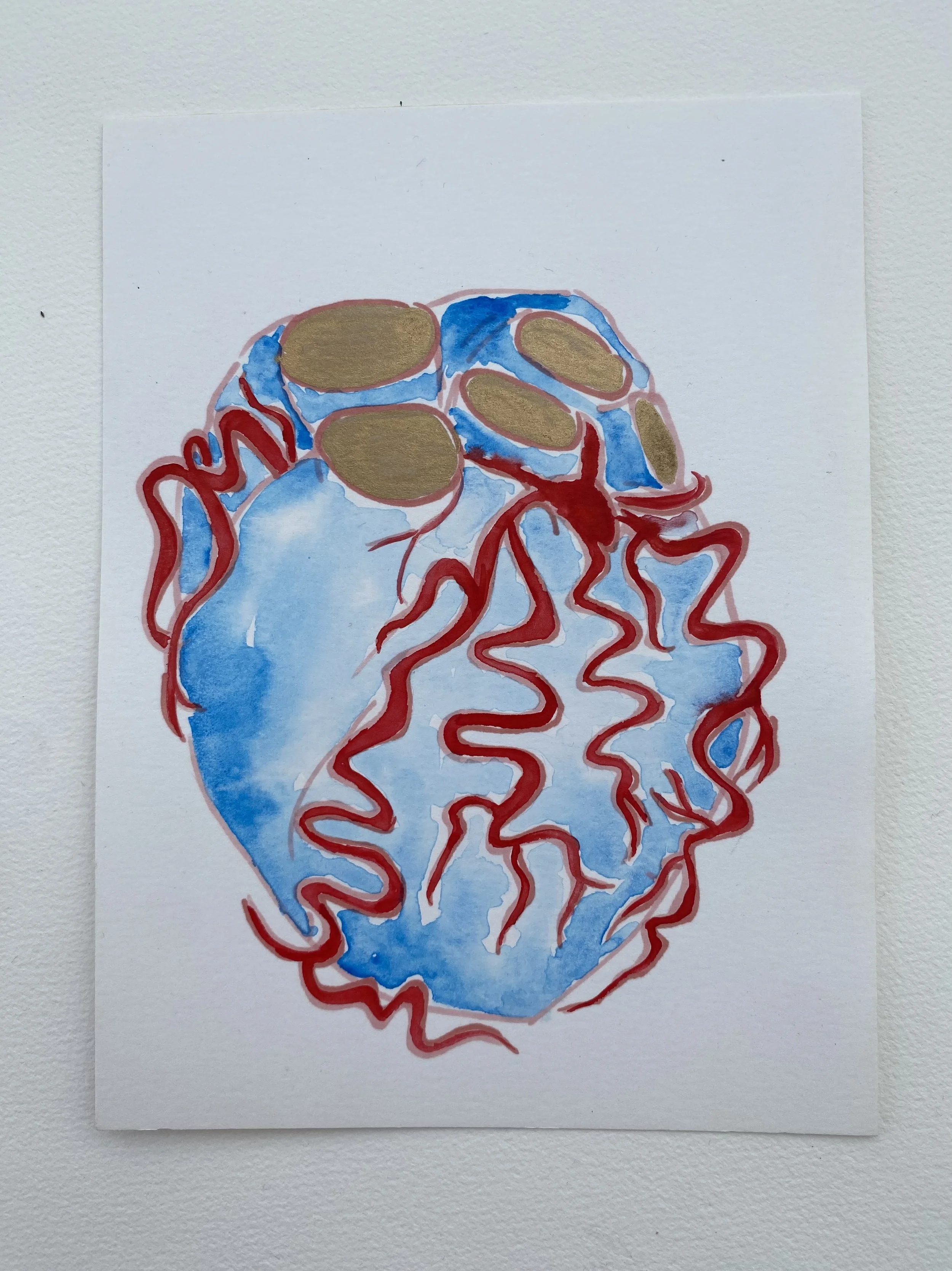 Wilder coronaries #2