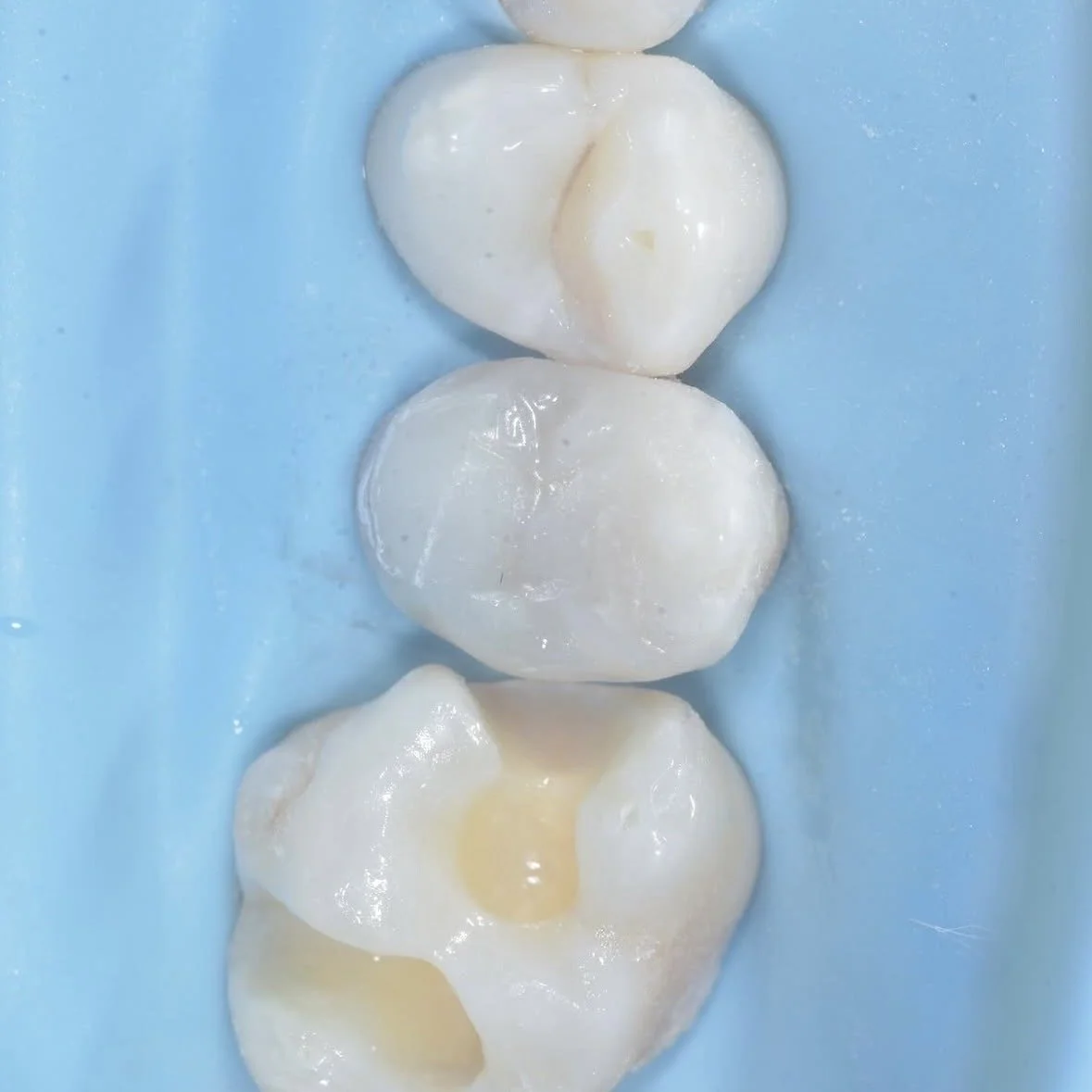 Biomimetic Dentistry, Biologic Dentistry and Holistic Dentistry: What is the Difference?