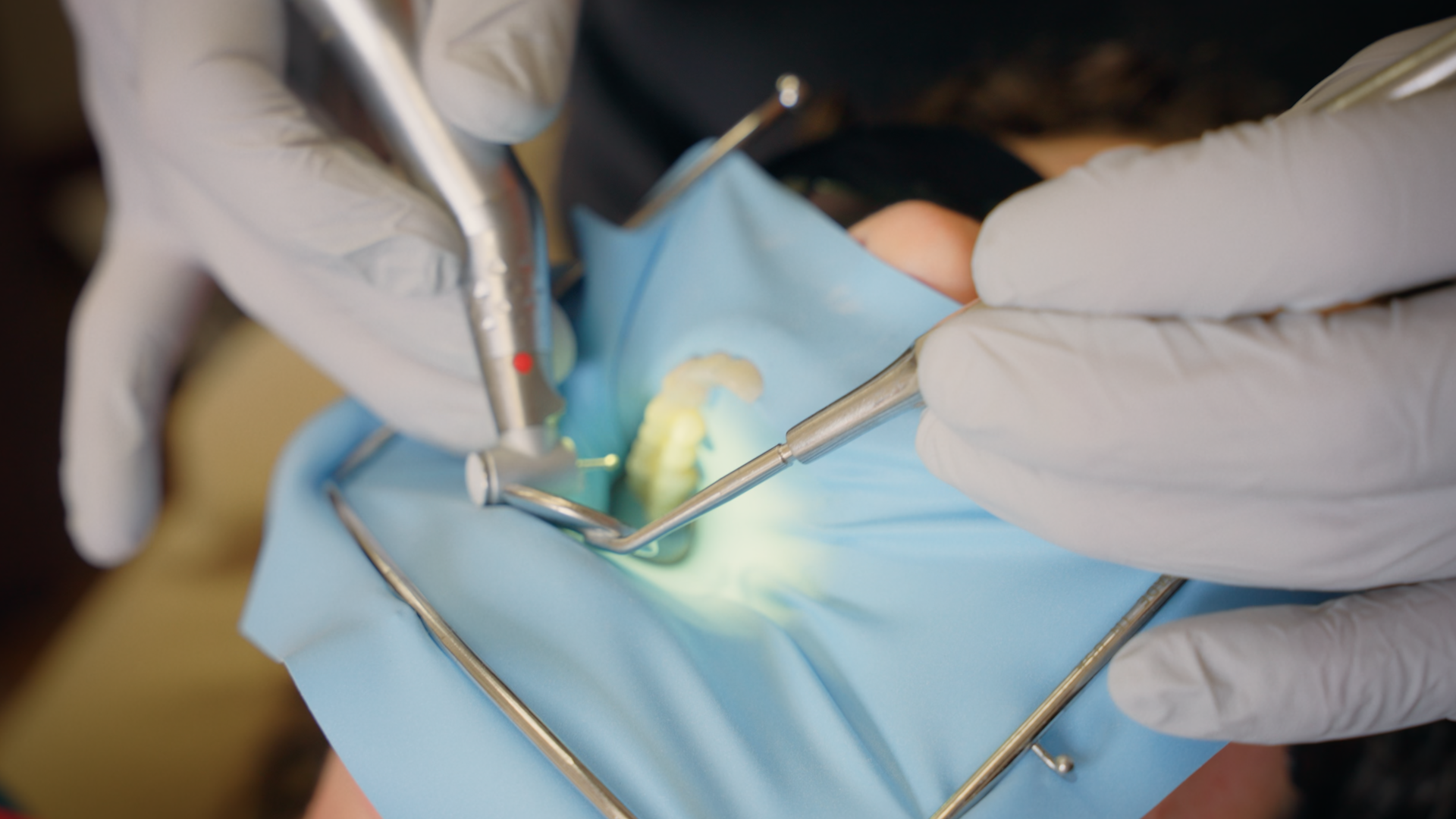 Restorative Materials Used at Alleman Dental