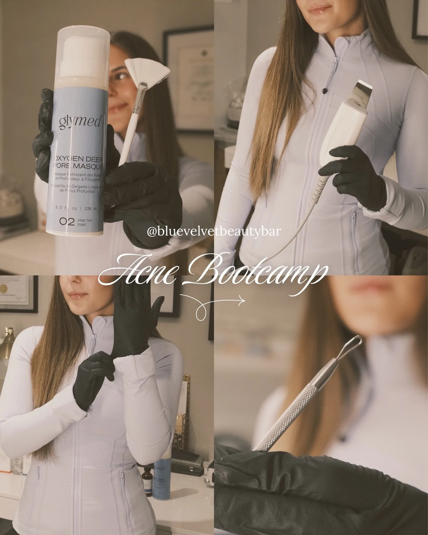 Acne is more than surface level &mdash; it can feel isolating and overwhelming. Endless products, trends, and advice make it hard to know what actually works.

I created the Acne Bootcamp to give you all the tools, education, and support to finally r