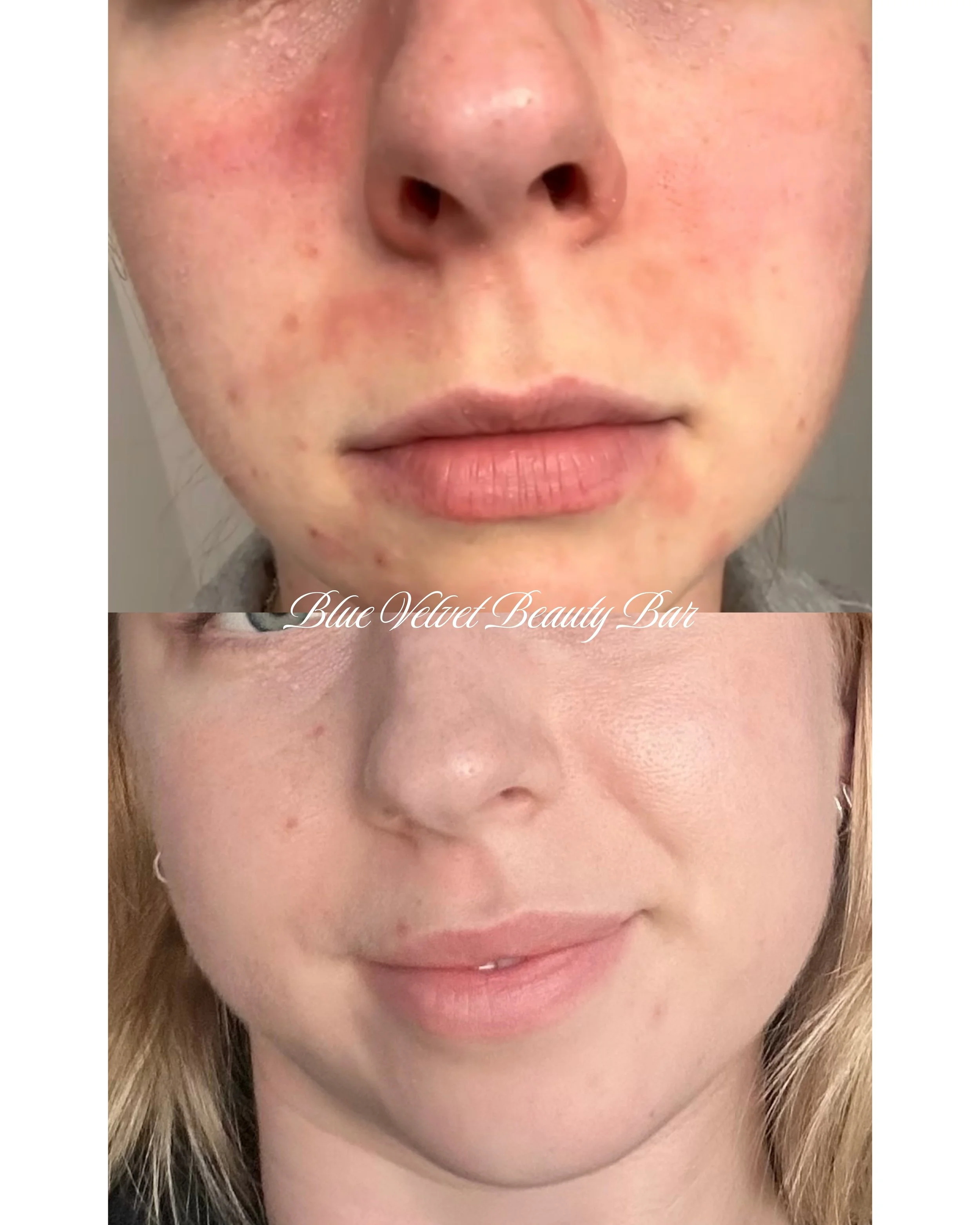 CLIENT PROGRESS.zip - 7.jpeg