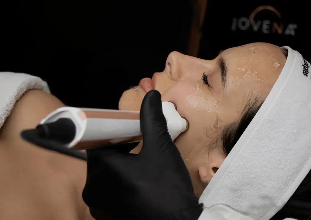 Facestim face lift Canterbury