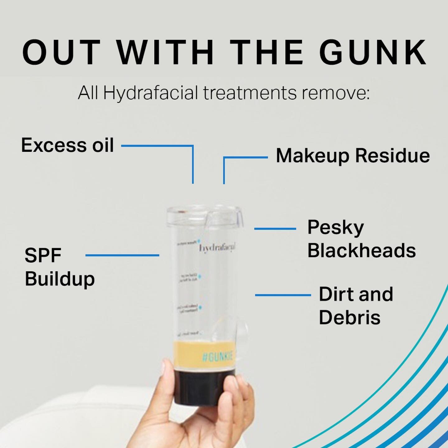 HALF PRICE 45 minute Hydrafacial with Kelly available tomorrow due to cancellation. 
・・・
What's in your Gunkie? 🔎

Gunkie jars are filled with a range of impurities, from blackheads to makeup residue. That's we recommend monthly Hydrafacials to help