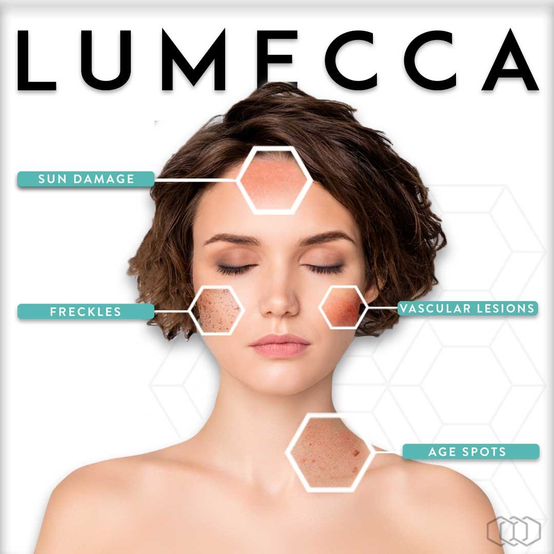 Illuminating Skin Rejuvenation with Lumecca IPL