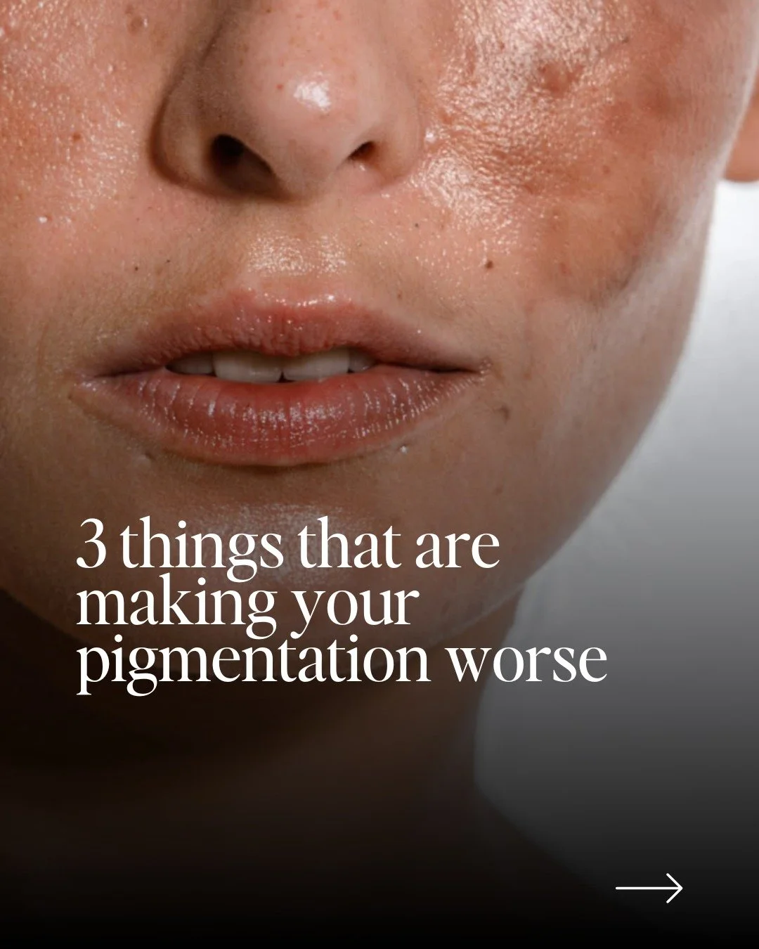Still struggling with stubborn pigmentation no matter what products you try?

Pigmentation isn&rsquo;t always just about sun damage, everyday habits and hidden triggers could be making it worse without you even realising.

From the way you use skinca