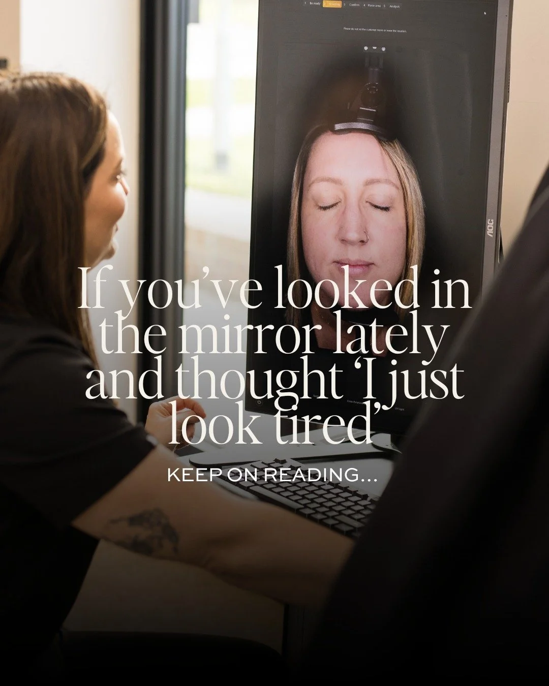 Ever catch yourself in the mirror and think, &ldquo;Why do I look so tired?&rdquo;, even after a good night&rsquo;s sleep?

It&rsquo;s one of the most common things we hear in clinic, and the truth is, it&rsquo;s rarely about rest. Fine lines, dullne