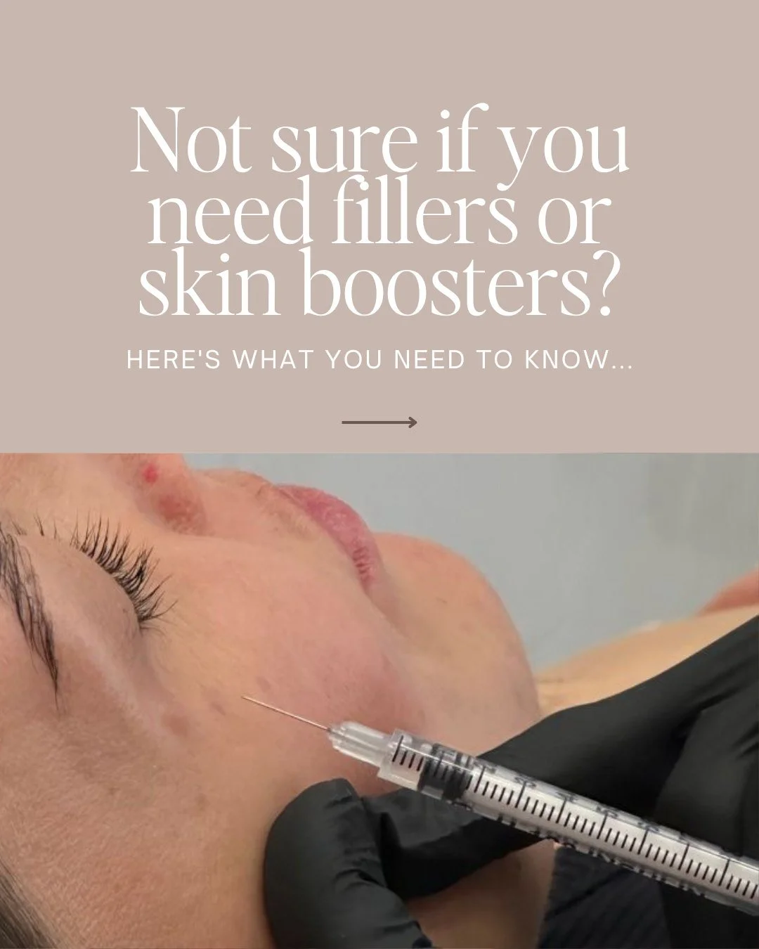 Ever wondered what the real difference is between fillers and skin boosters, and which one is right for you?
It’s one of the most common questions we’re asked in clinic, especially by women who want to look fresher and more confident wit