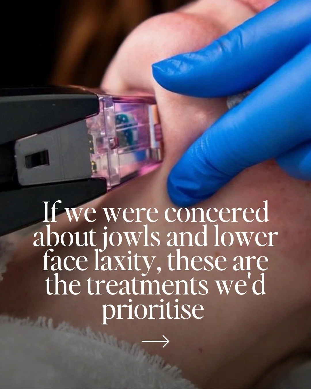 If you&rsquo;ve started noticing softening around the jawline or heaviness in the lower face, it&rsquo;s completely understandable to wonder what actually works, and what might make things worse.

Jowls and lower face laxity are nuanced concerns, and