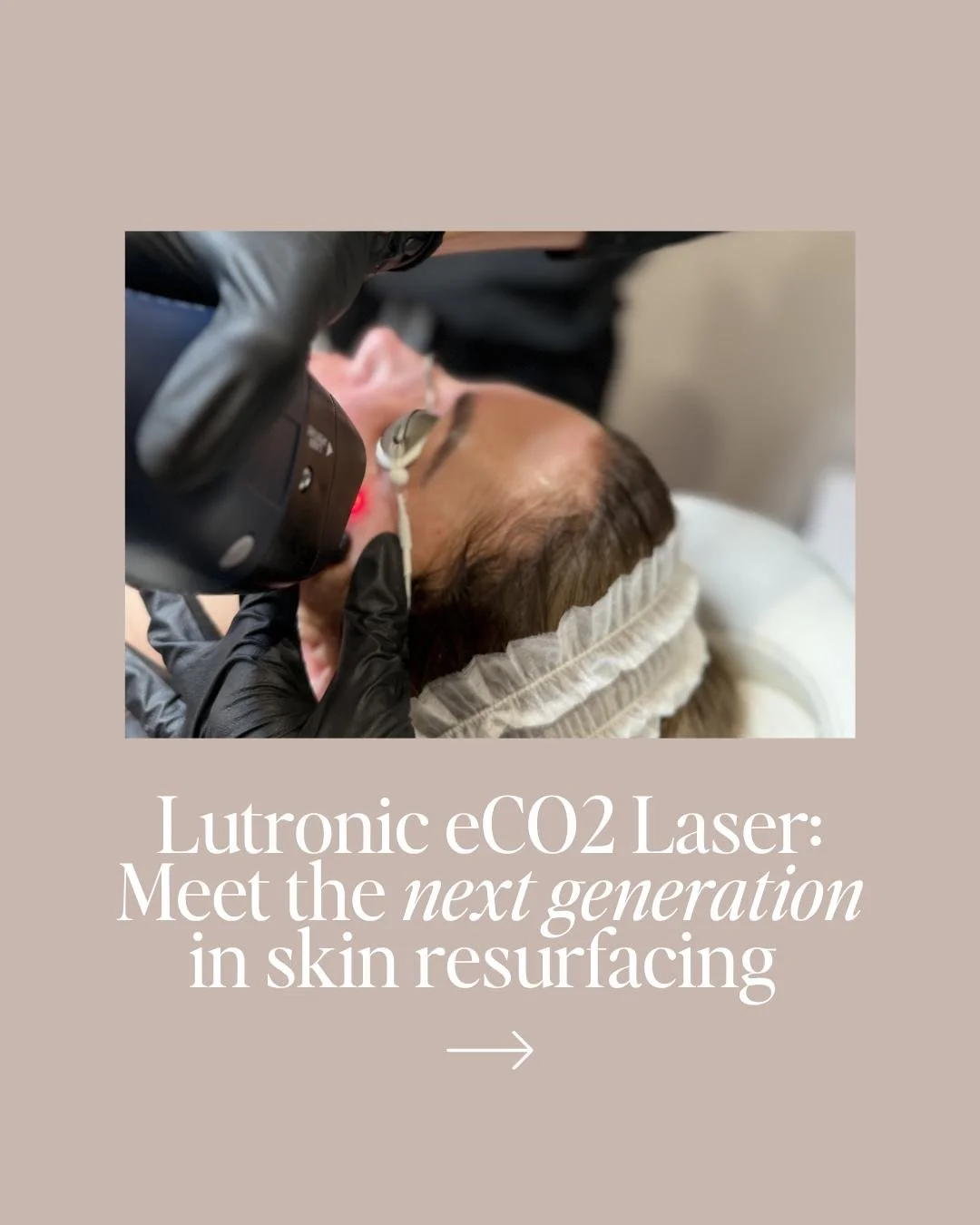 Not all lasers are created equal, and when it comes to resurfacing, the device you're treated on changes everything.

We're so excited to introduce the Lutronic eCO2 laser to our treatment menu. It's one of the most advanced resurfacing lasers availa