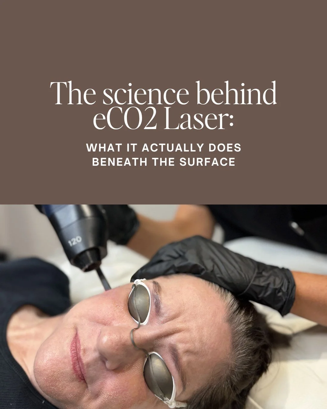 Most people who look into laser treatments focus on what they can see-the pigmentation, the texture, the lines.

What's less talked about is what's actually happening underneath, and understanding that is what makes the difference between treating a 