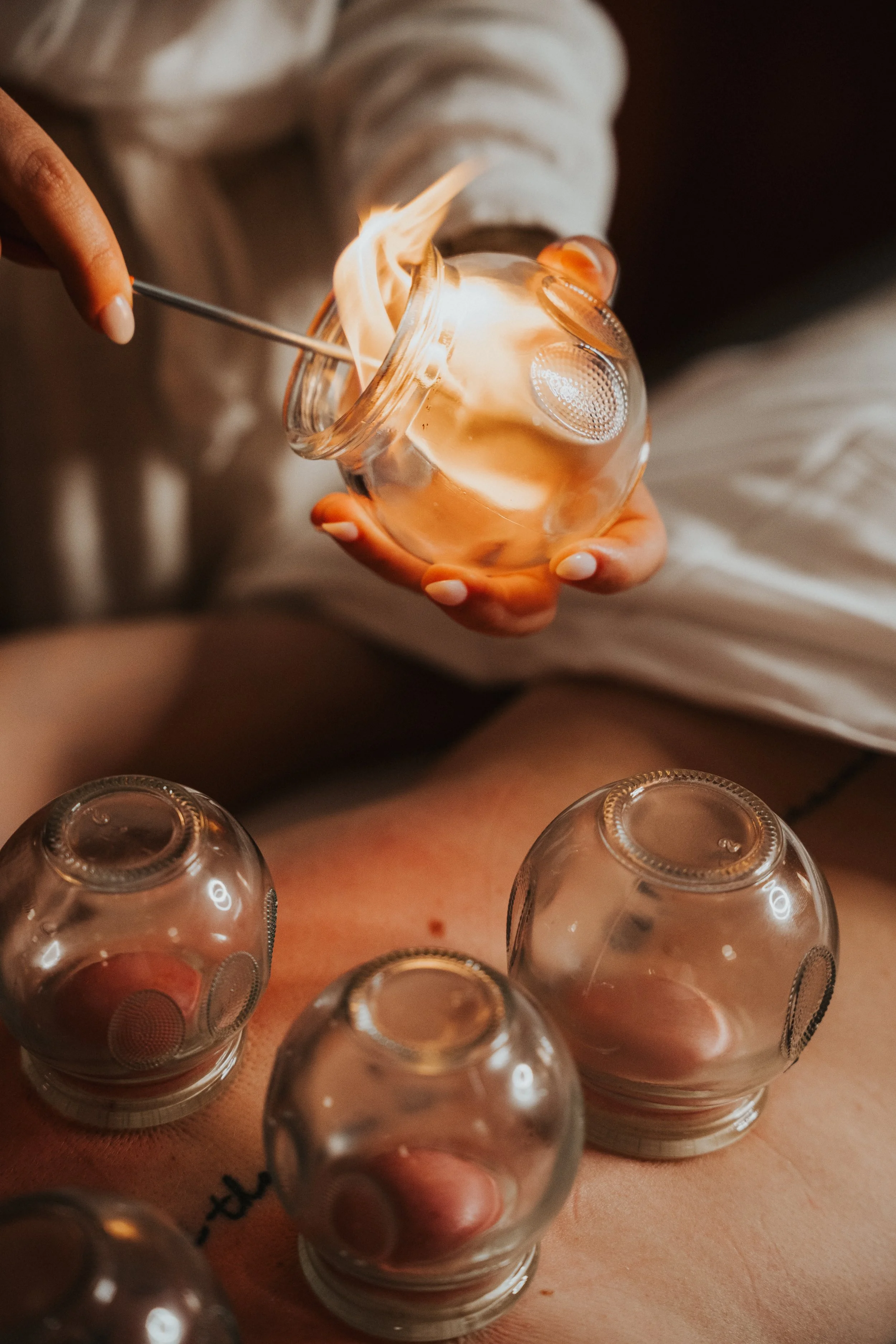 CuppingSolDen.jpg