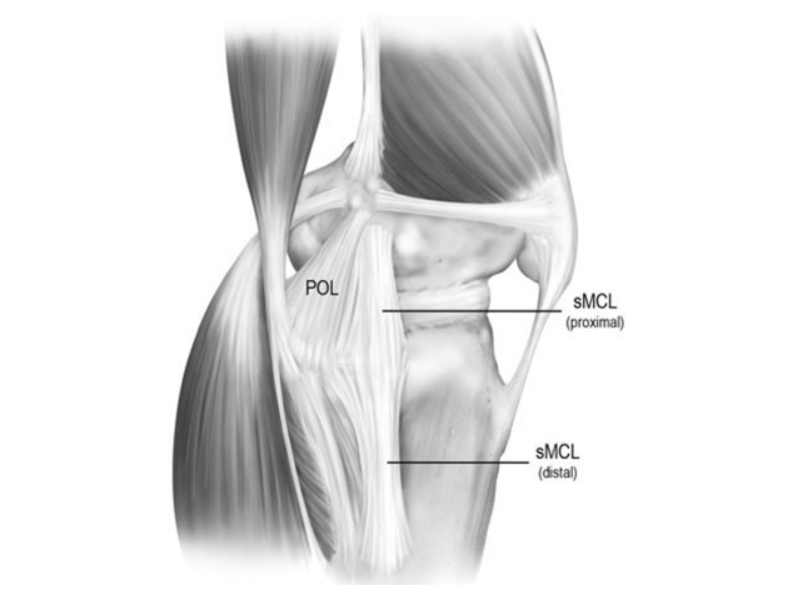 MCL Sprain Rehab — Soccer Rehab