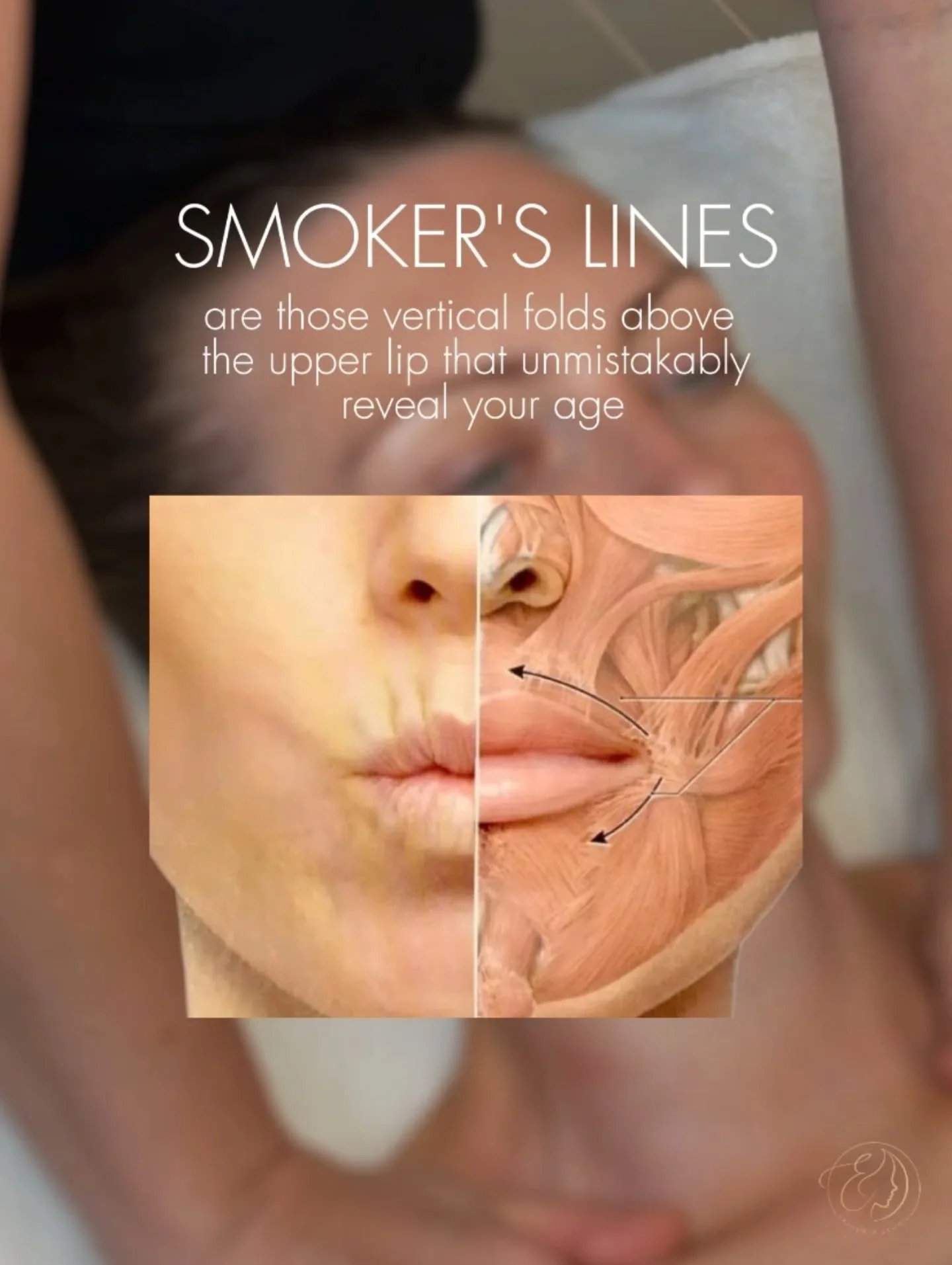 💆&zwj;♀️ Worried about wrinkles around your mouth? There&rsquo;s a solution - buccal massage!

This technique works the facial muscles not only from the outside, but also from the inside - through the mouth. 

The results:
🔹 reduced wrinkles around