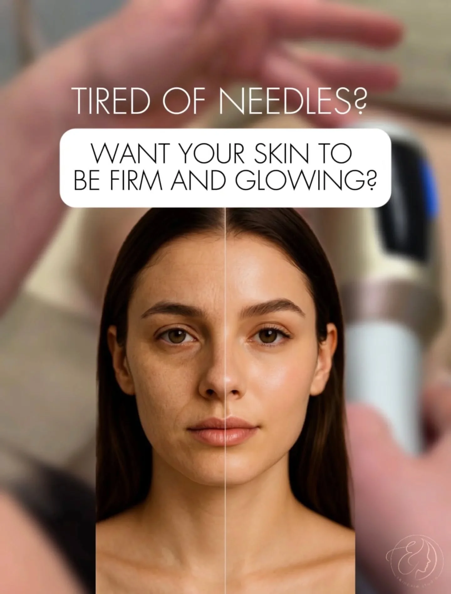 Endospheres for the face: wrinkles smooth out, contours lift, and skin glows✨

Wrinkles aren&rsquo;t just about age. They&rsquo;re the result of chronic muscle tension, lymph stagnation, and decreased tissue tone. And Endospheres tackles this better 