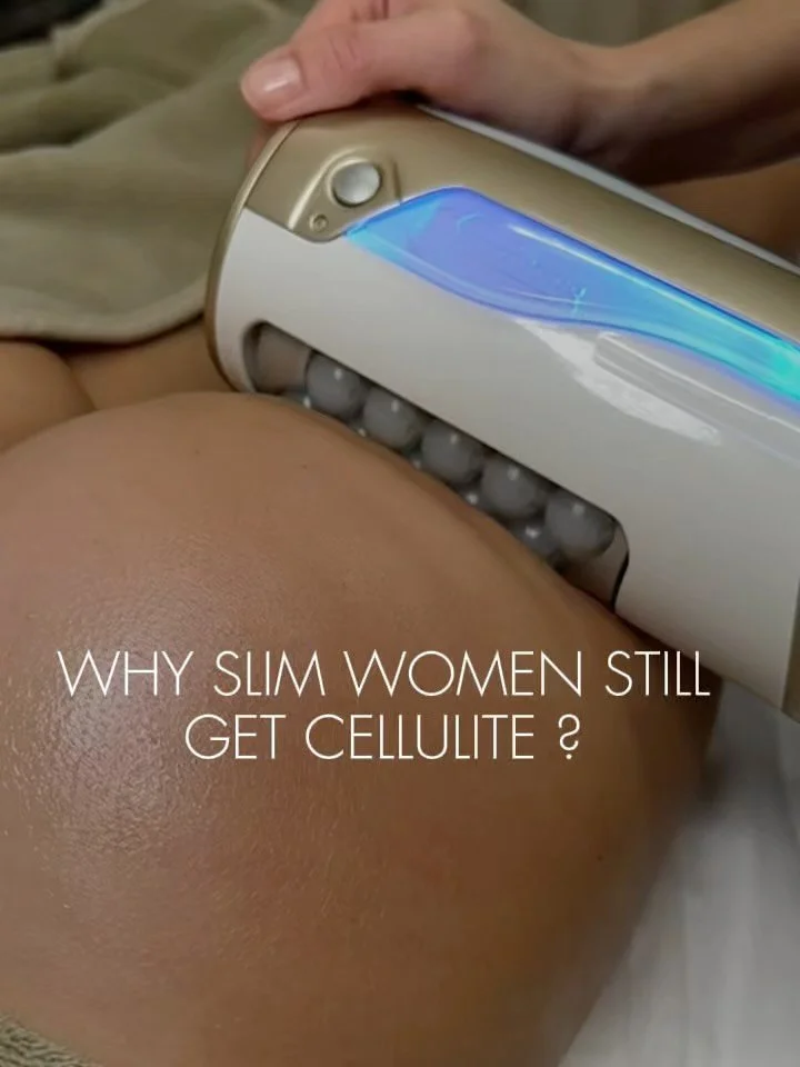✨ Cellulite can appear even in slim women - it&rsquo;s not about excess weight, but about connective bands and stagnation.

The good news - Endospheres really helps:
✅ Smooths out bumps and &laquo;orange peel&raquo; without ultrasound or vacuum; 
✅ D
