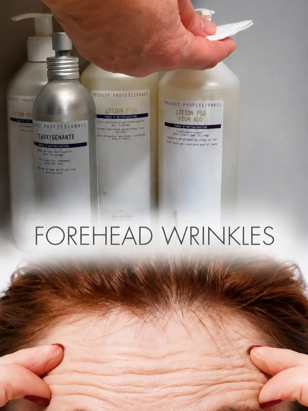Forehead wrinkles: there is a solution!✨

Active facial expressions, stress, and age are the main culprits behind forehead lines. But there&rsquo;s a way to combat this problem!

Professional facial massage:
🔹Improves blood circulation;
🔹Stimulates