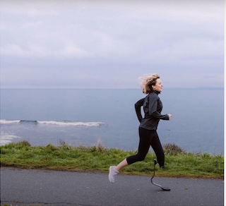 Life with Limb Loss: Building Resiliency