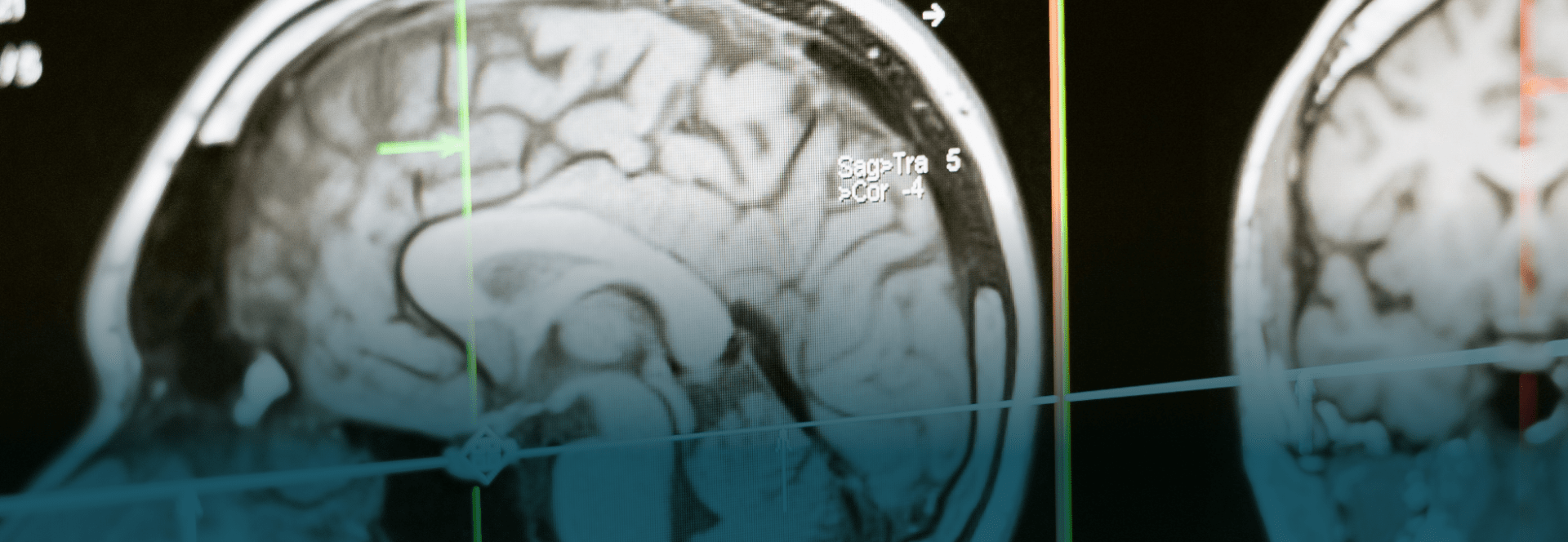 Resources — Medical Imaging Consultants