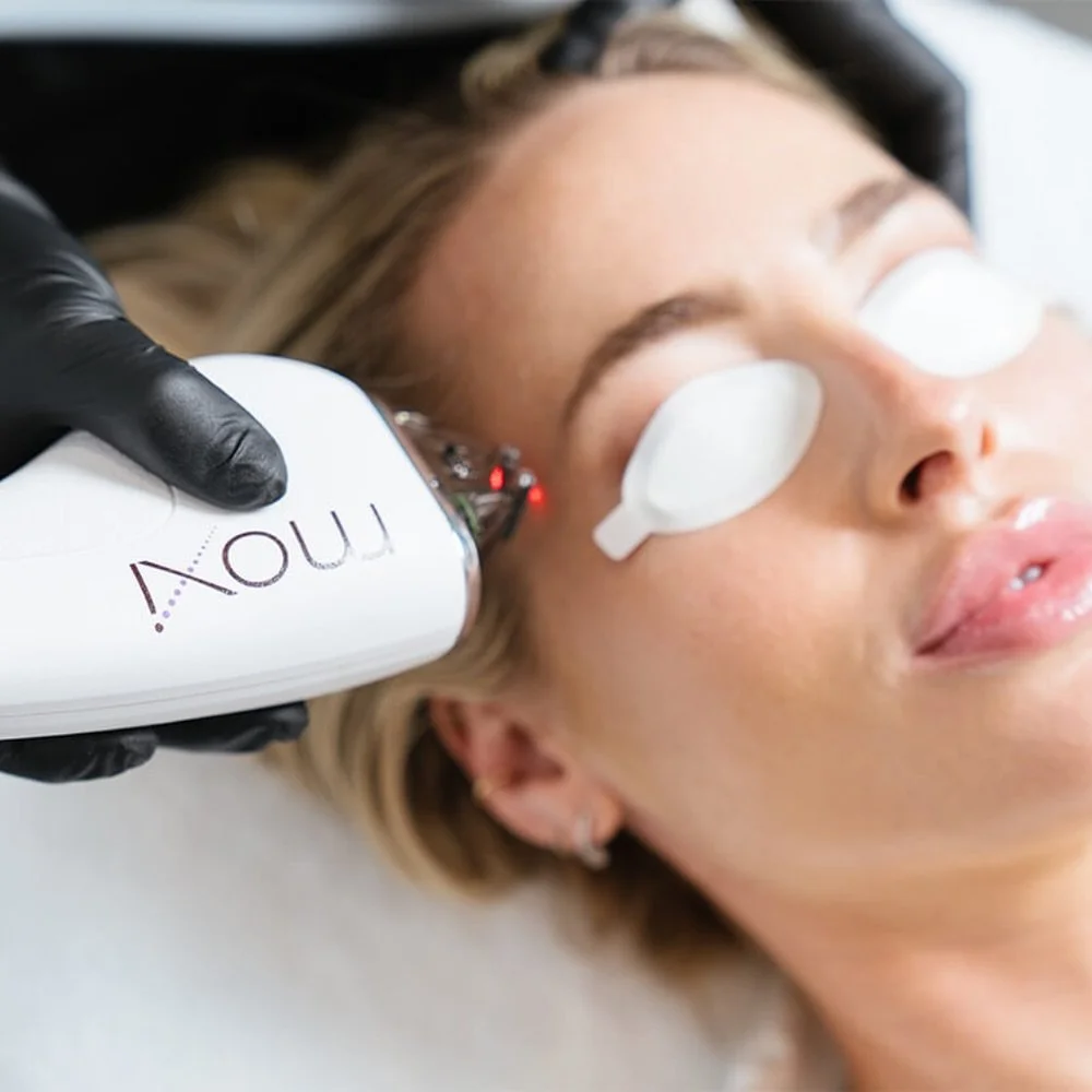 🚨 GIVEAWAY DAY 4 🚨
Our 3rd anniversary celebration continues! Almost at the end of our week long giveaway now! Keep commenting on any of our giveaway posts for your chance to win ☺️
For DAY 4, we have a $600 MOXI treatment! Swipe through to see r