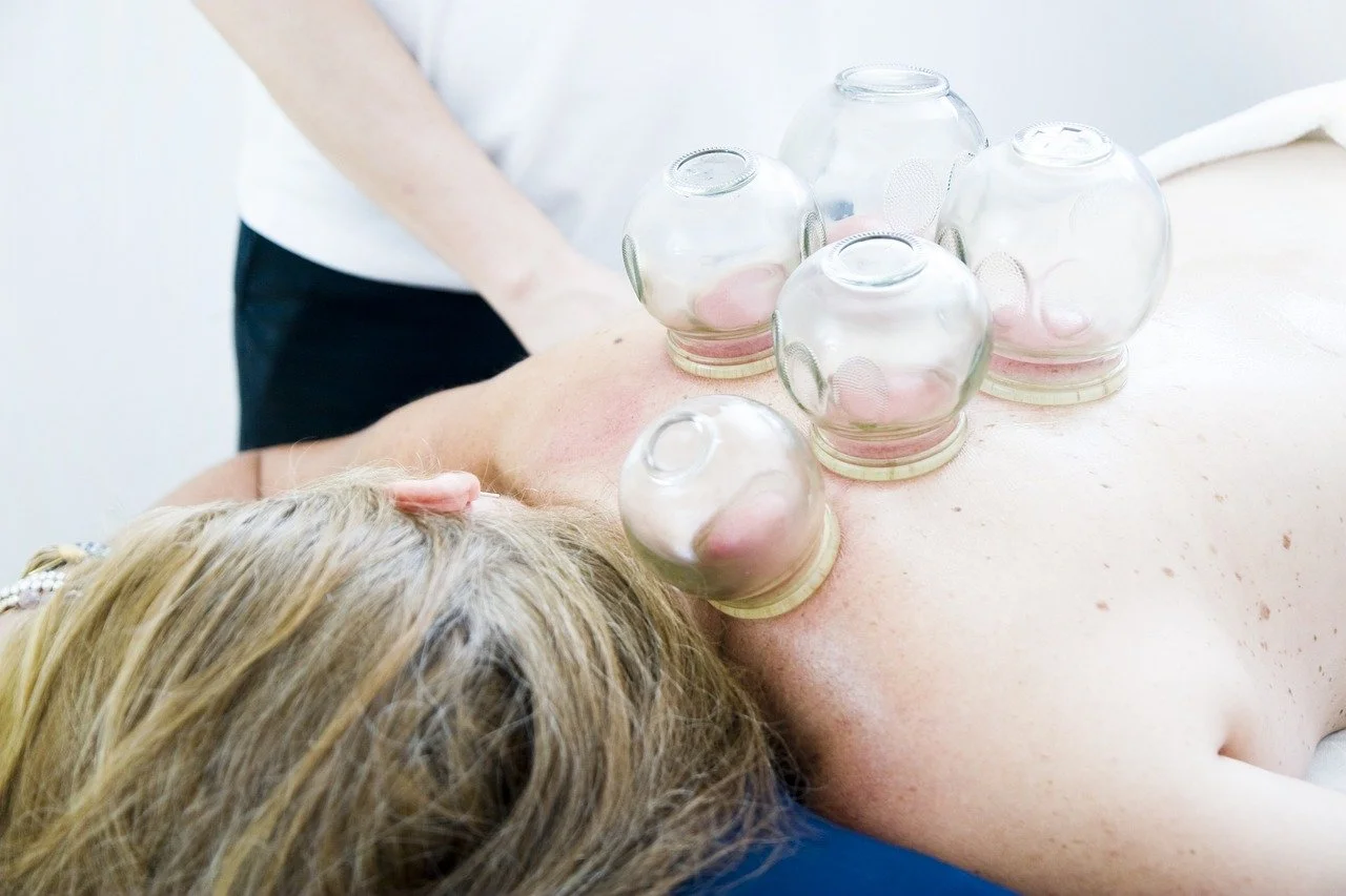 What is Cupping in Massage Therapy?