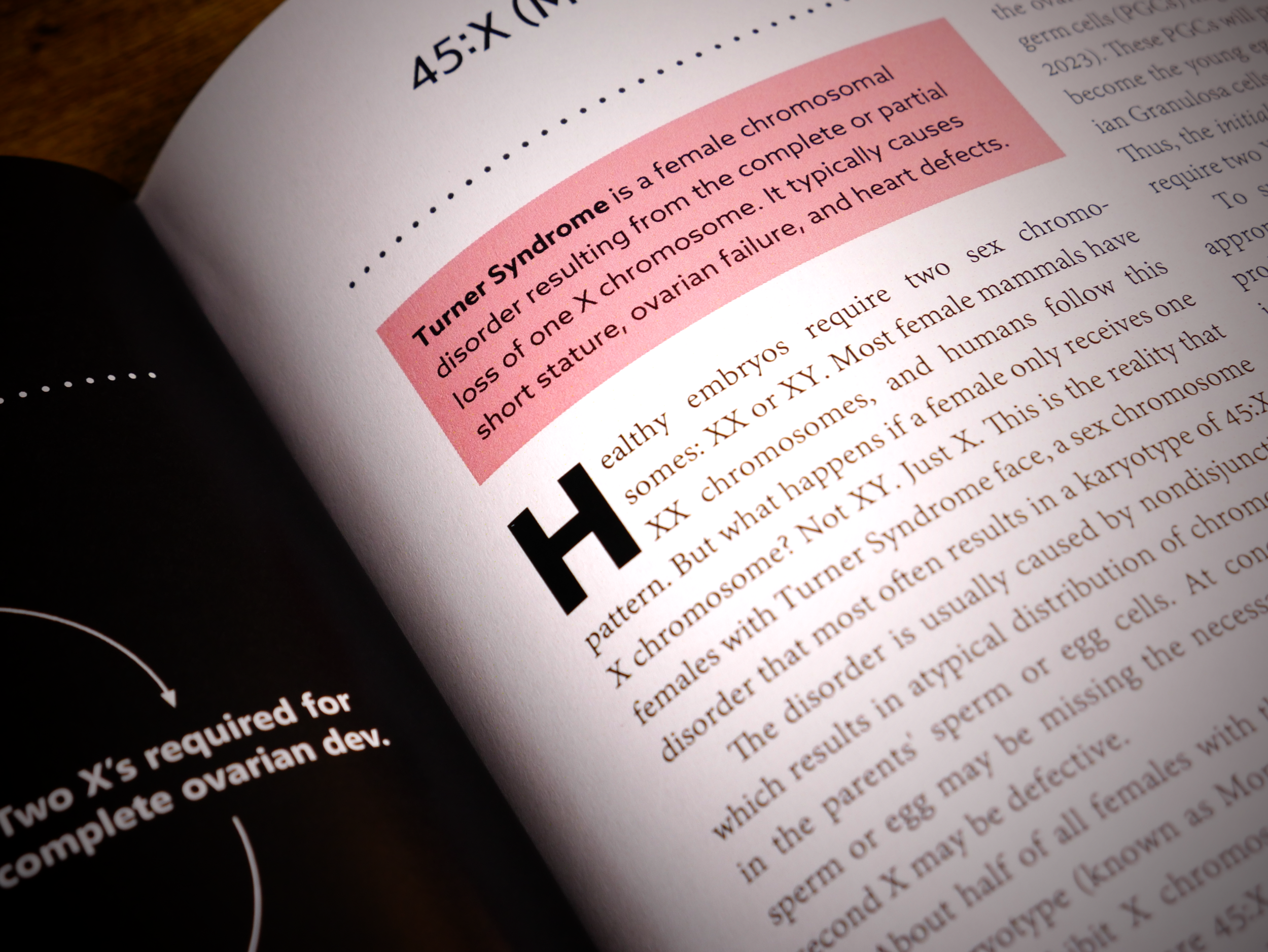 Turner Syndrome Commentary.png