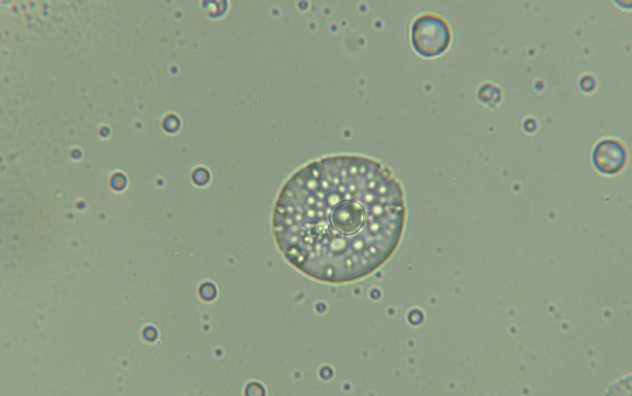 Microscopic view of a round, patterned cell or organism with numerous small internal structures, surrounded by smaller circular particles.