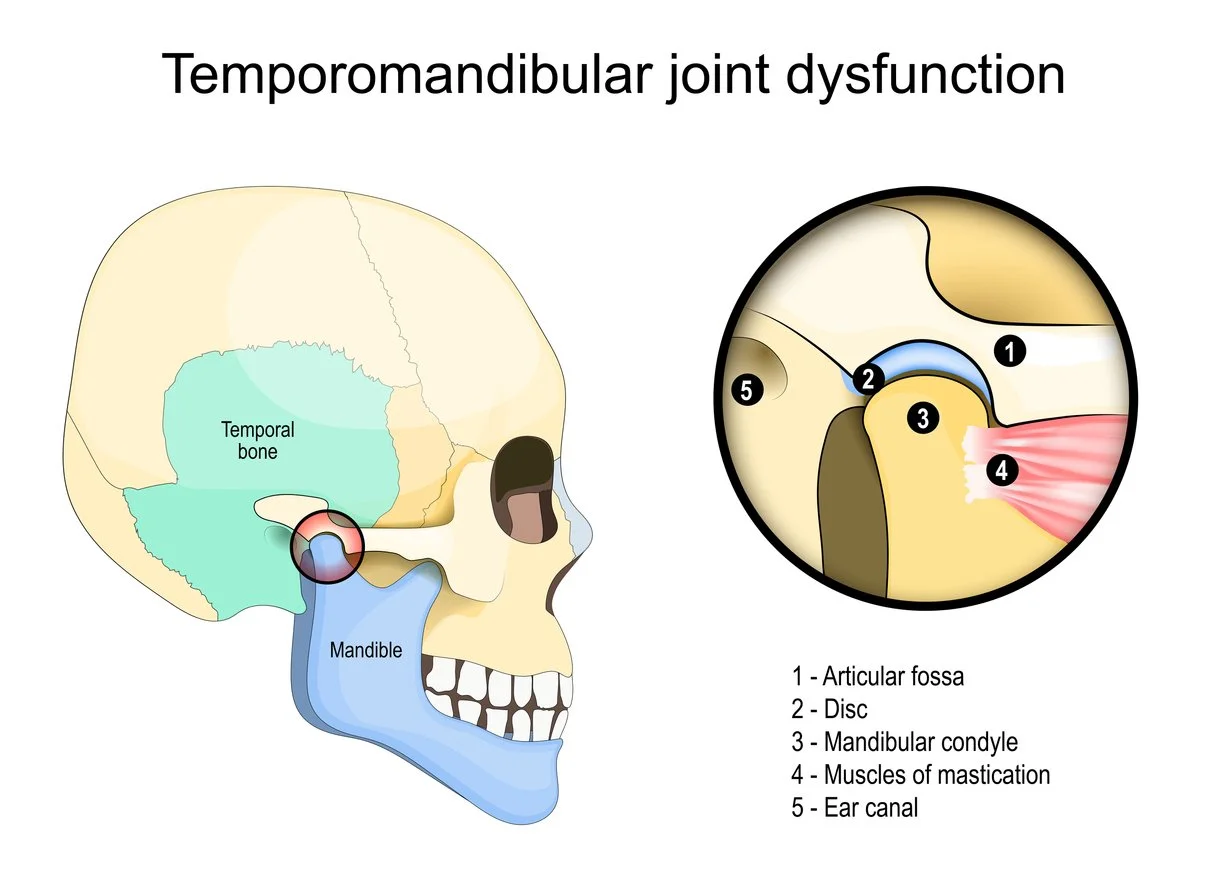 TMJ Disorder and Treatment