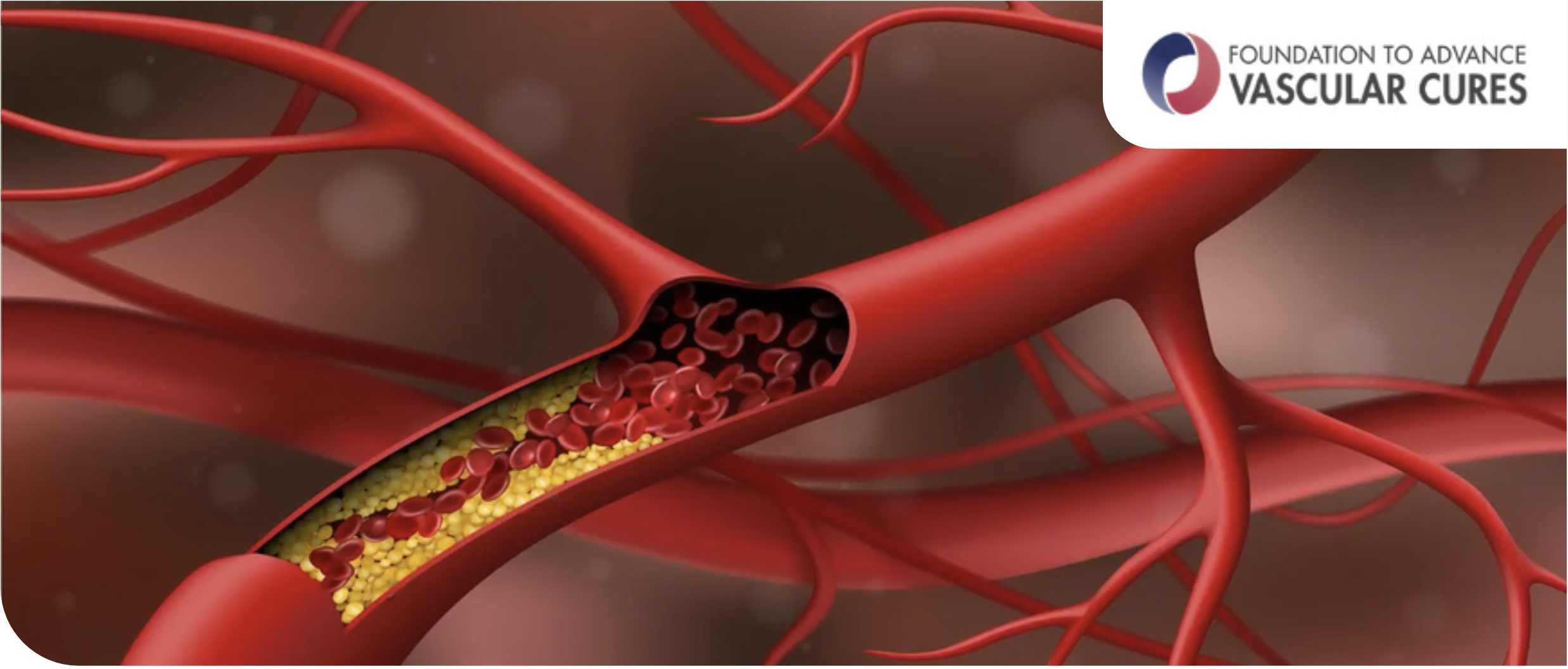 Cholesterol