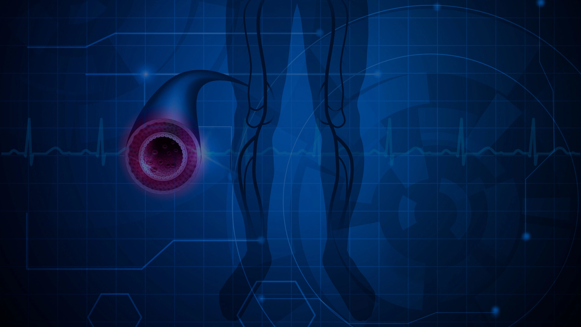 What is Vascular Disease? The Foundation to Advance Vascular Cures