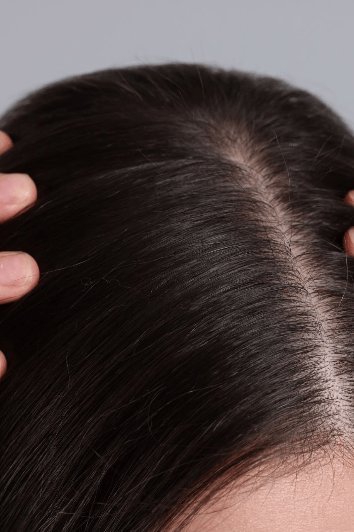 Dry Scalp or Dandruff? Here’s How to Tell the Difference