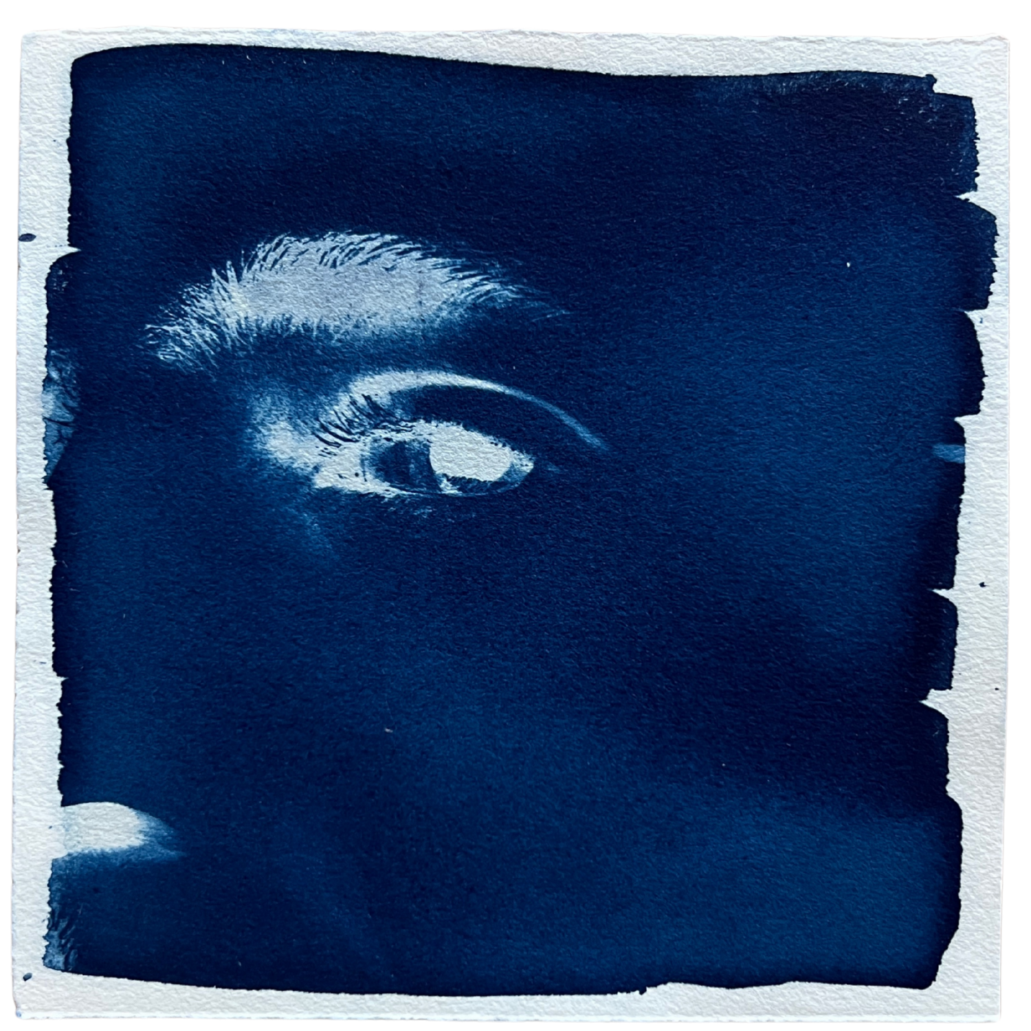 Eye