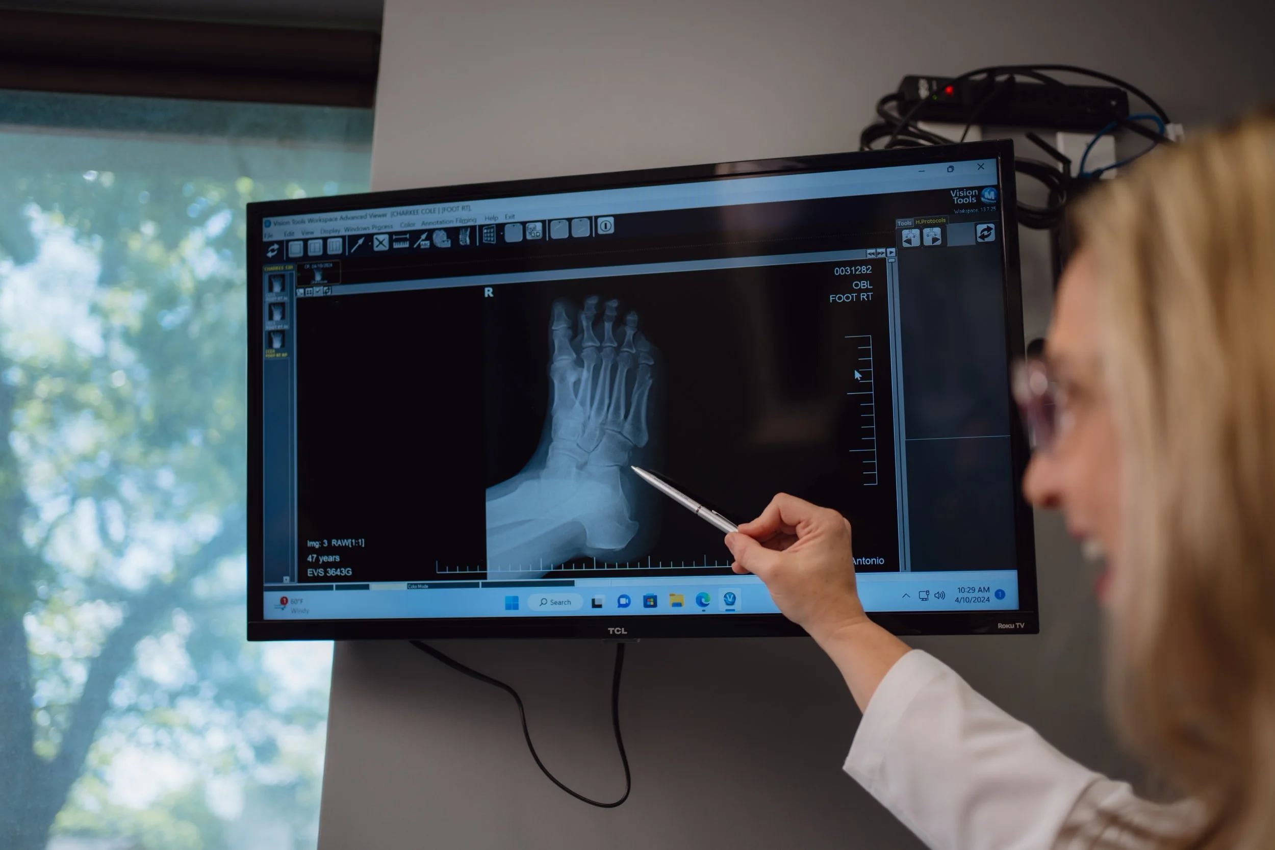 Ankle Replacement Foot and Ankle Specialist in San Antonio at Ortho San Antonio
