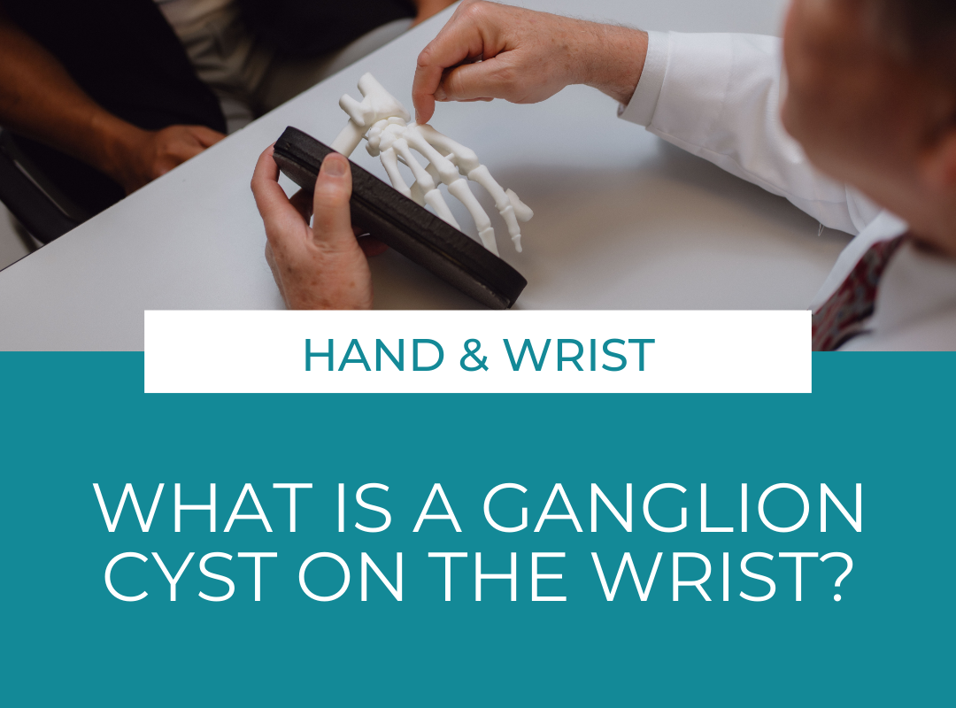 What Is a Ganglion Cyst on the Wrist?