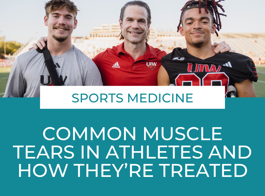 Common Muscle Tears in Athletes and How They’re Treated