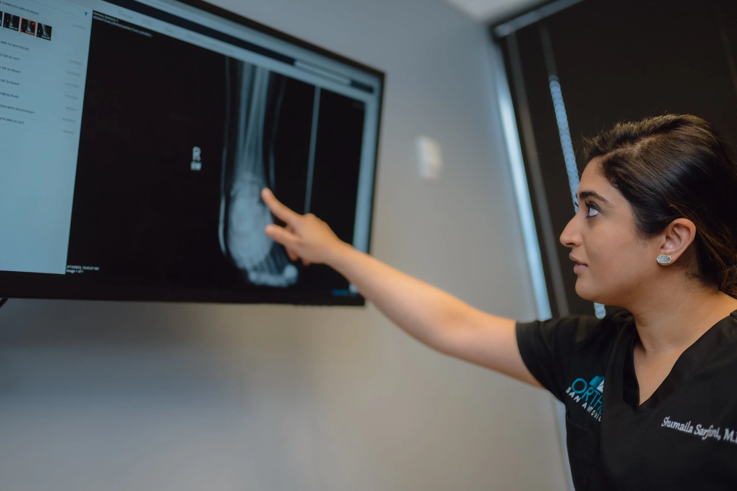 Sarfani with x-ray of soccer foot injury at ortho san antonio