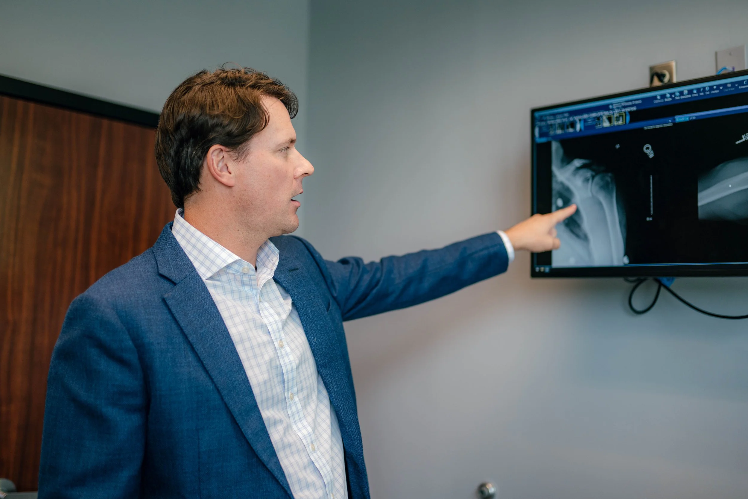 Shoulder replacement in San Antonio at ortho san antonio