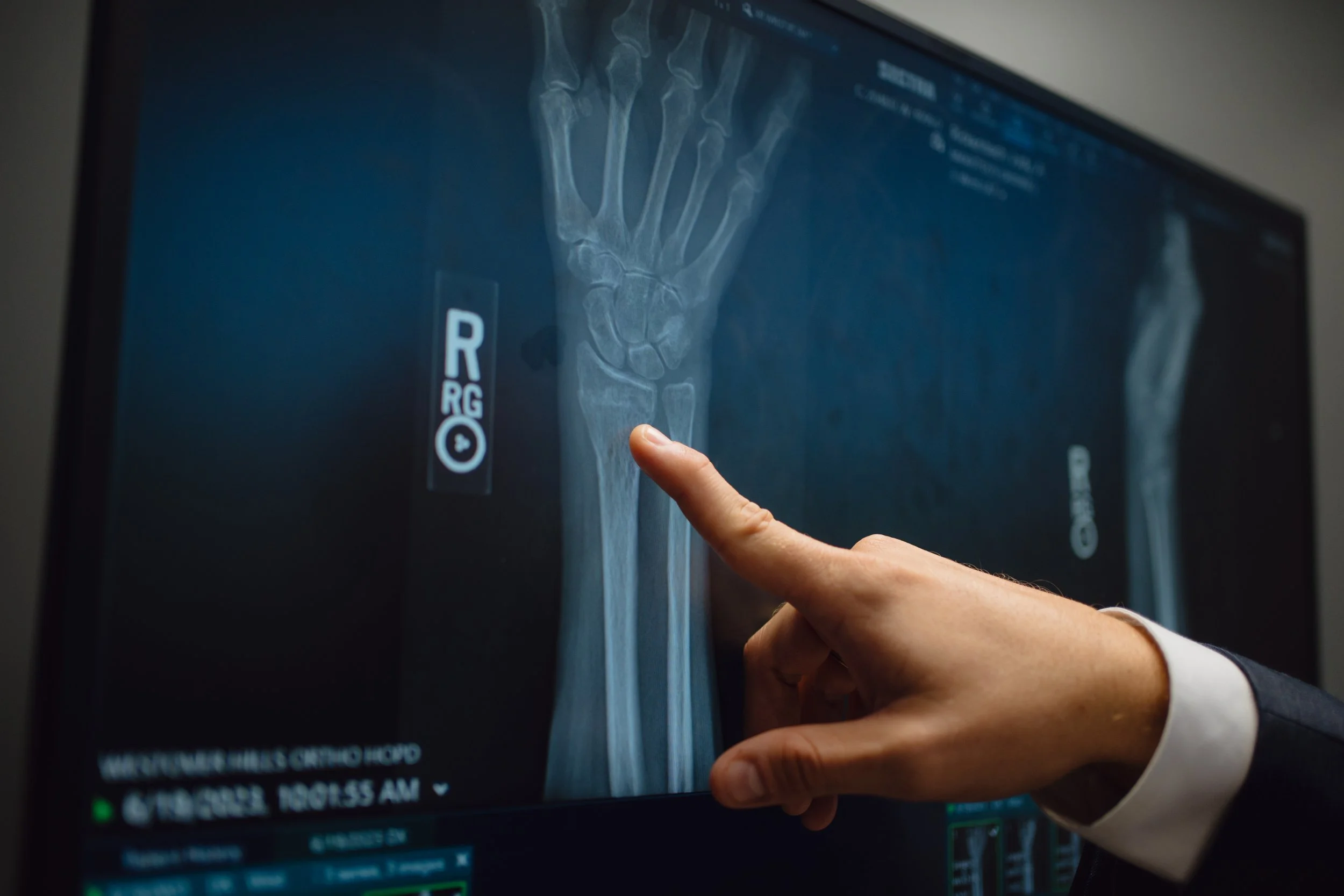 Arthritis Associates In San Antonio at Willie Hargrave blog