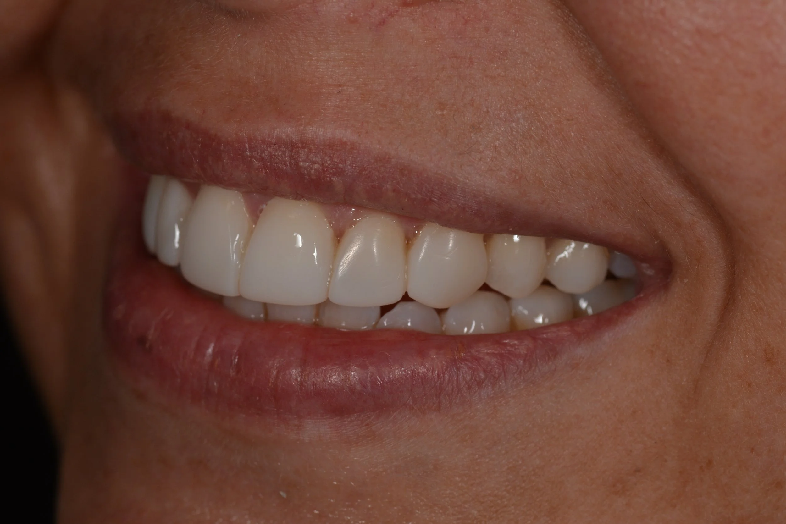 Services 1 — Serenity Dental Care